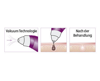 BEURER Porenreiniger FC40