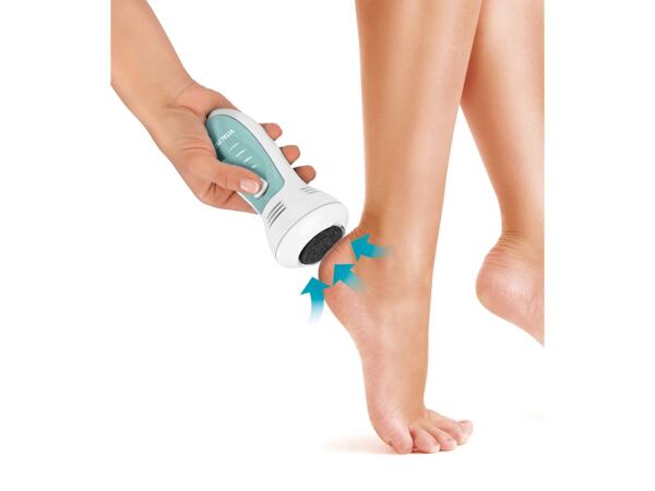 Callus remover