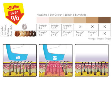 SILK'N Haarentfernungsgerät mit Lichttechnologie